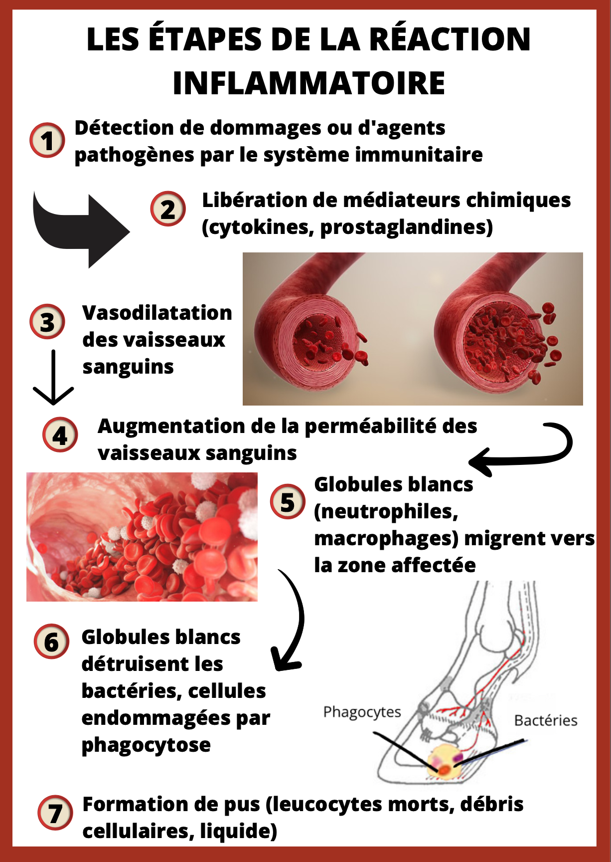 infographie creation inflammation
